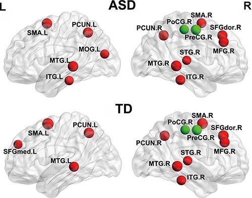 The distribution of hub regions in typical development (TD) and autism spectrum disorder (ASD) groups The distribution of hub regions in typical development (TD) and autism spectrum disorder (ASD) groups