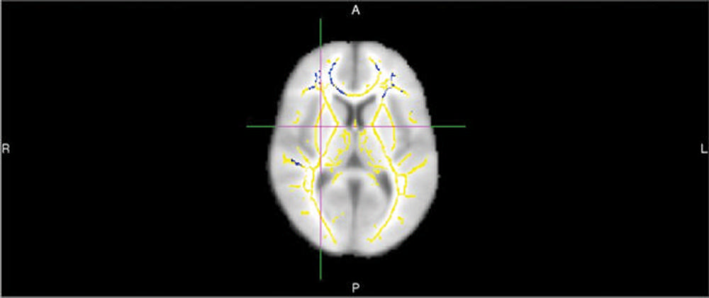 Brain News Release