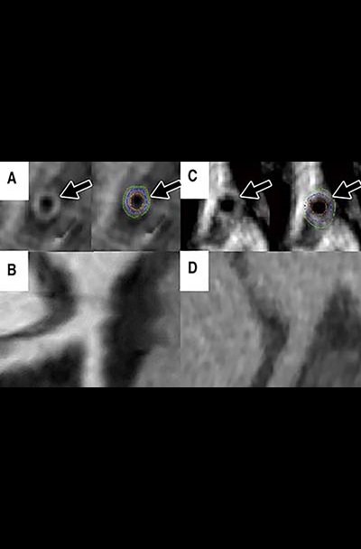 Gharem Figure 3