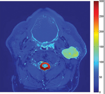 Salivary Glands Research Fig 1