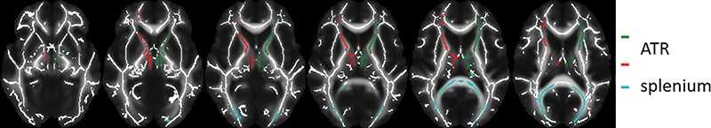 ADHD research