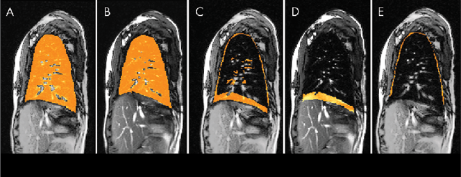 Spine Figure 3