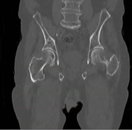 Prostate Research