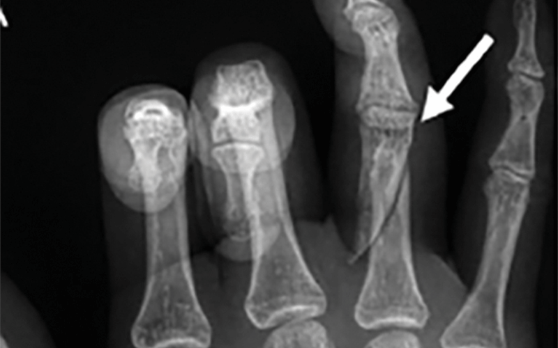 Domestic violence X-ray