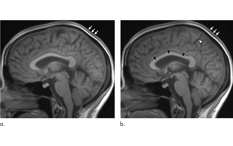 Kramer Fig. 4