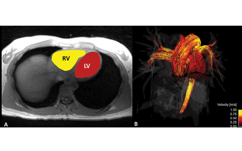 Next Gen MRI research image