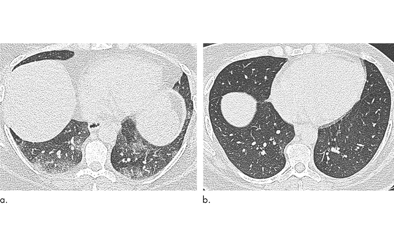Copley figure 3