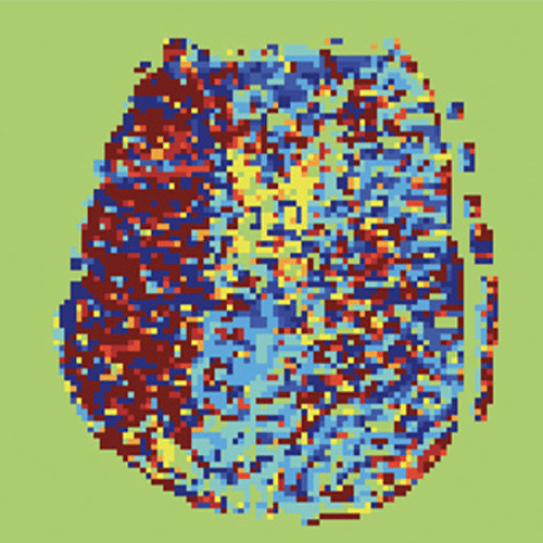 Heit Figure 2