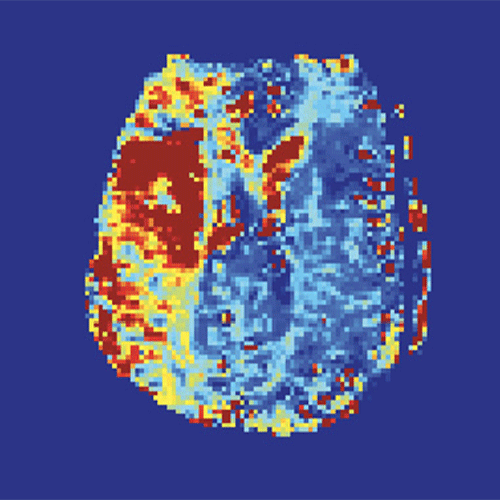 Heit Figure 3