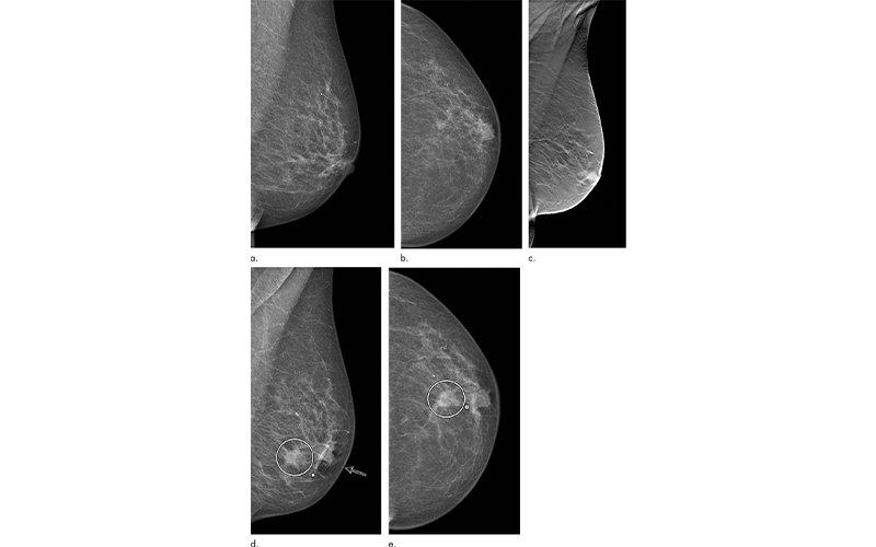 Johnson Fig 2 feature