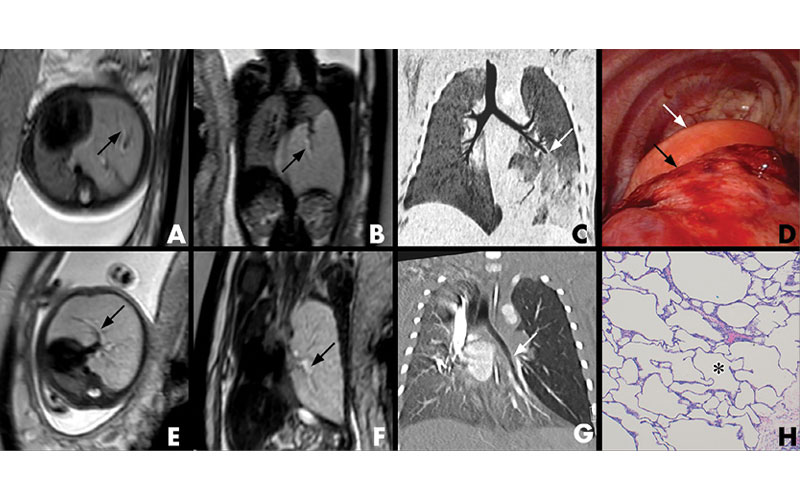 fetal imaging research