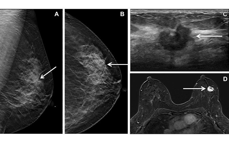 Gao Figure 3