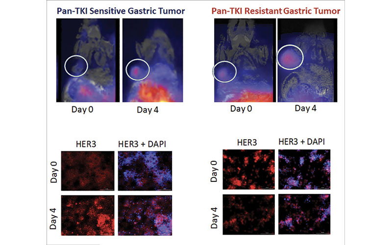 Esfahani gastric cancer image