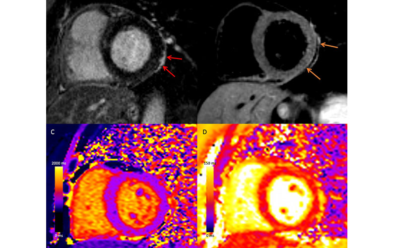 Hannemann research image