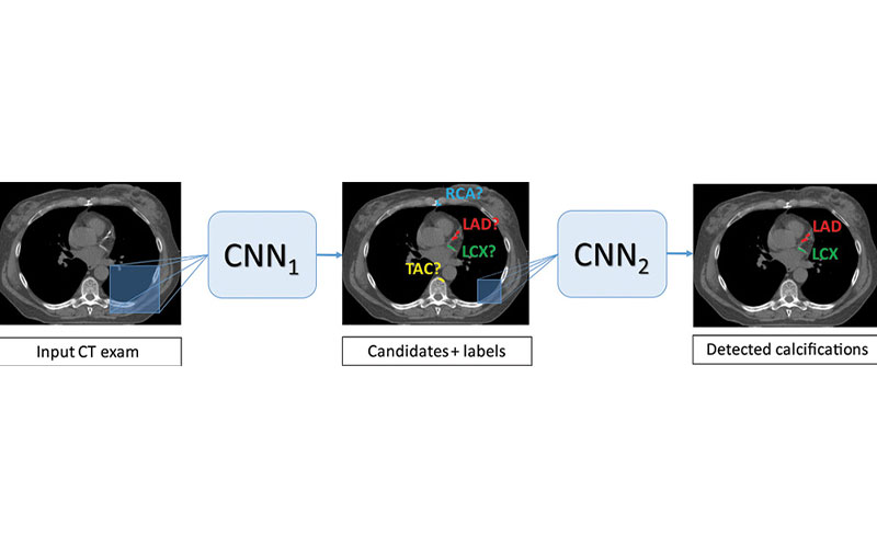 Isgum research image