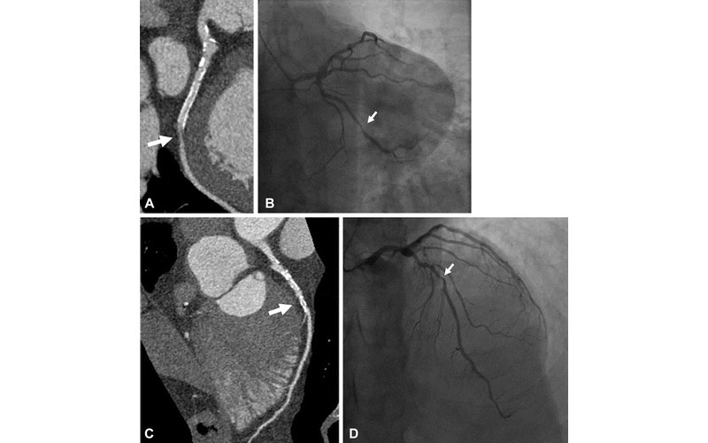 Zadeh research image 1