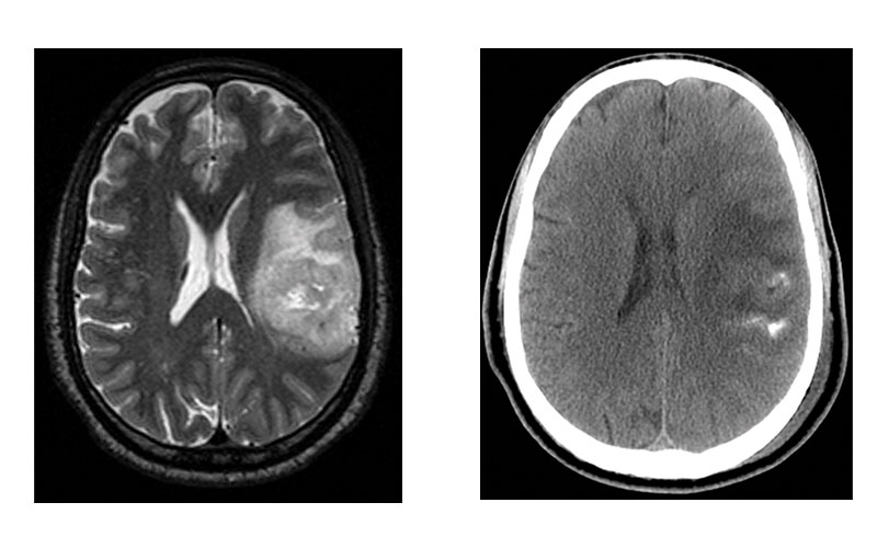 Sohil Patel AB feature