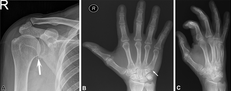 Fig 5 Guermazi