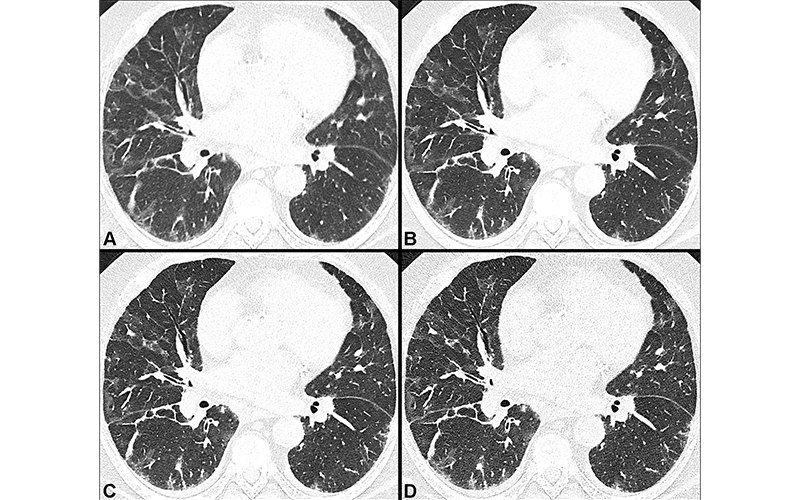 Fig 4 Heidinger