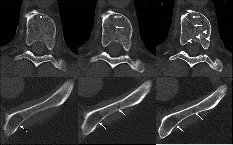 Fig 5 Baffour