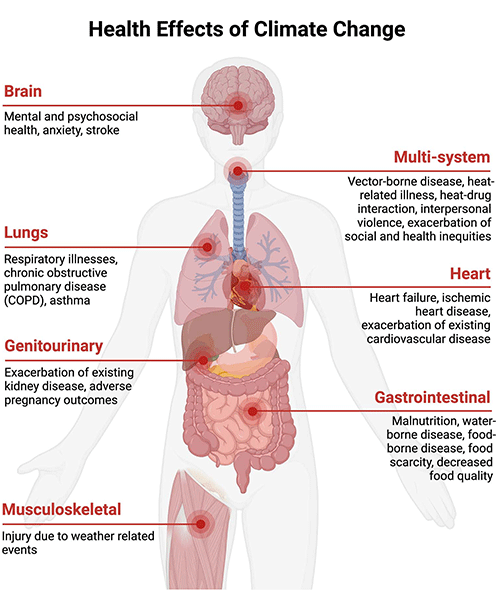 More Health Risks Climate Change Special Report Looks at Radiology’s Role in Combatting Climate Change ...