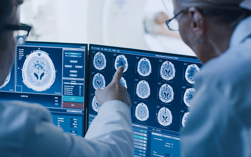 Rads looking at MRI brain images feature
