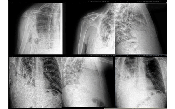 Gusar medical 6