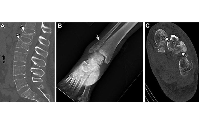 Radiology eating disorder imaging Solomon