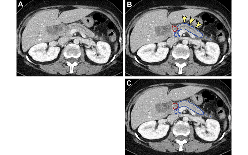 Chen Margulis Fig 5 Radiology