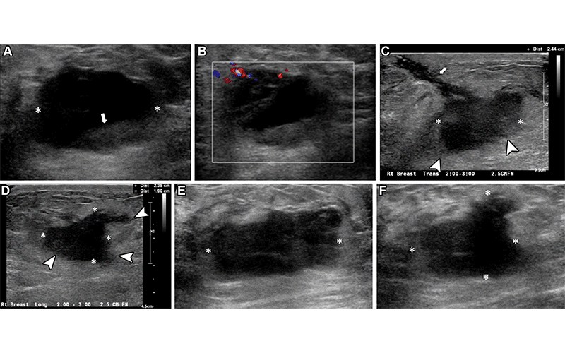 Breast findings in the ER RG
