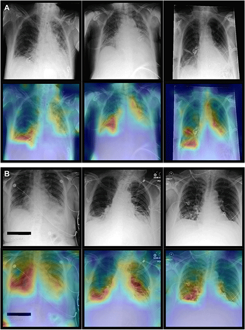 Khader RY Fig 5 AI combines chest X-ray with patient data