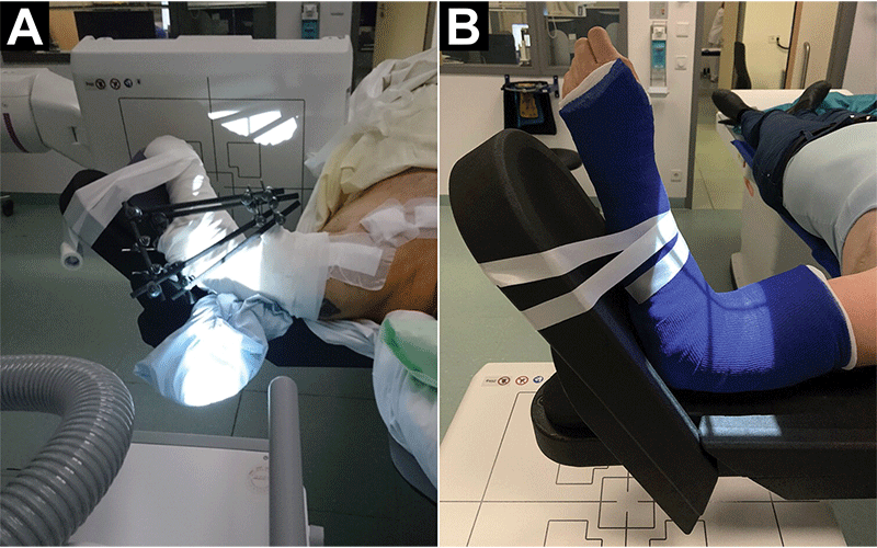 Cone Beam CT For Elbow Imaging | RSNA