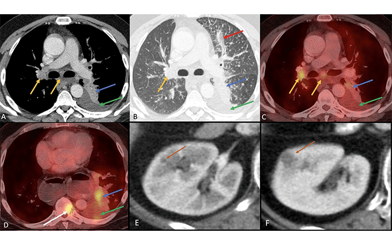 Liu Radiology Image