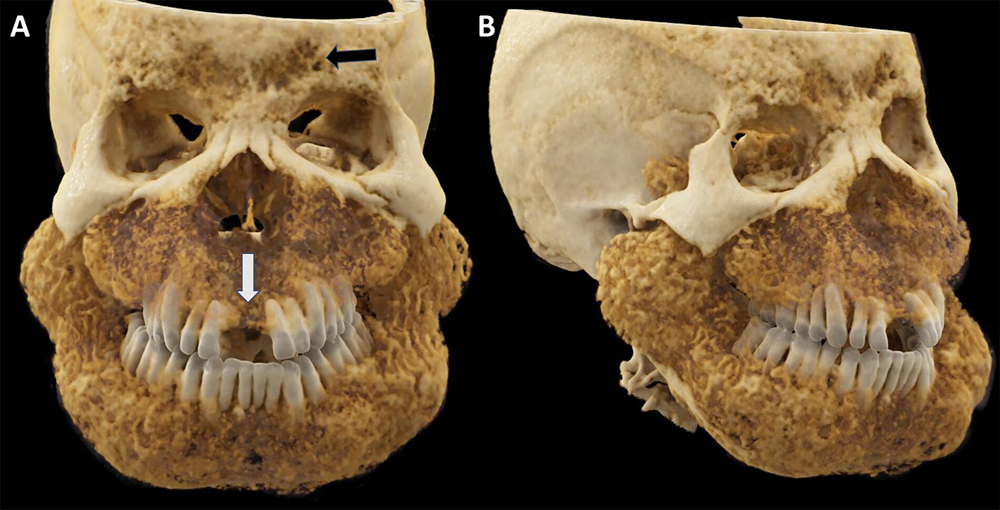 Top Radiology Image 2 2024