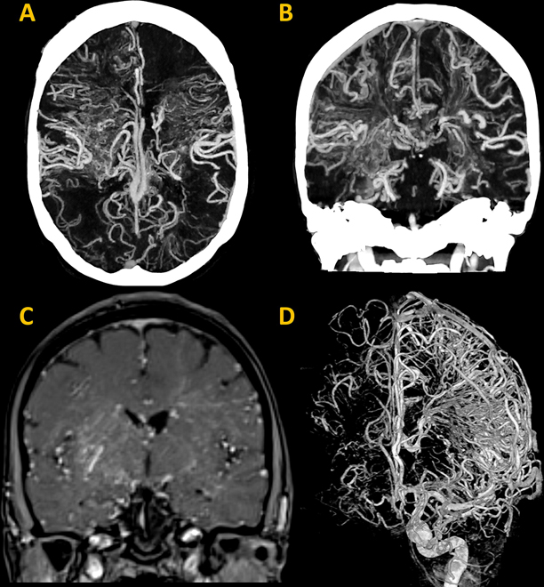 Top Radiology Image 3 2024