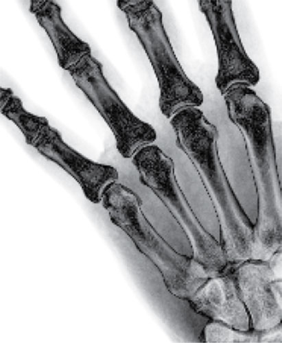 Stylized image of a hand X-ray