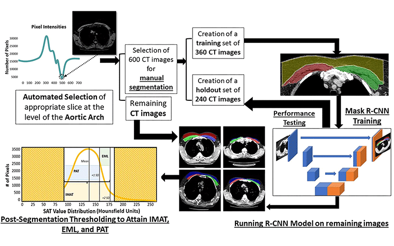 Workflow of deep learning algorithm development