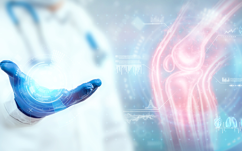 MSK image; gloved hand; X-ray image