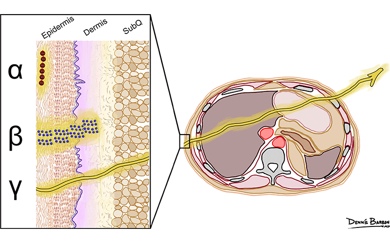 Radiology Theranostics image https://doi.org/10.1148/rg.230097