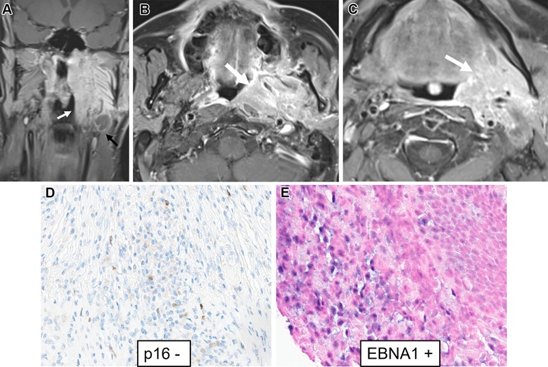 Agarwal RadioGraphics https://doi.org/10.1148/rg.240037