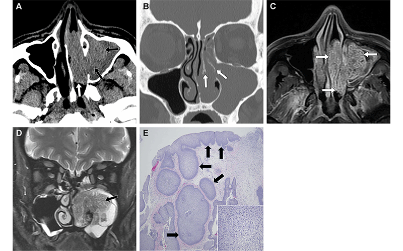https://doi.org/10.1148/rg.240035 © RSNA 2024