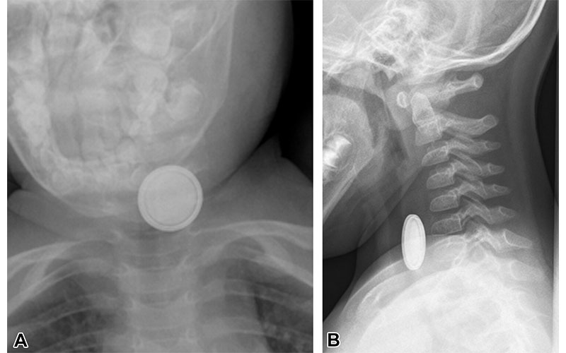 Foust RG Pediatric https://doi.org/10.1148/rg.240027