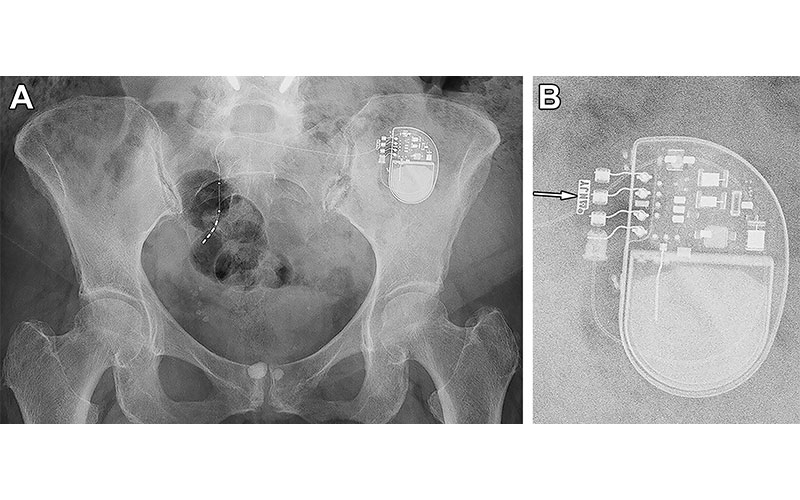 Harwood Radiology https://doi.org/10.1148/rg.230102
