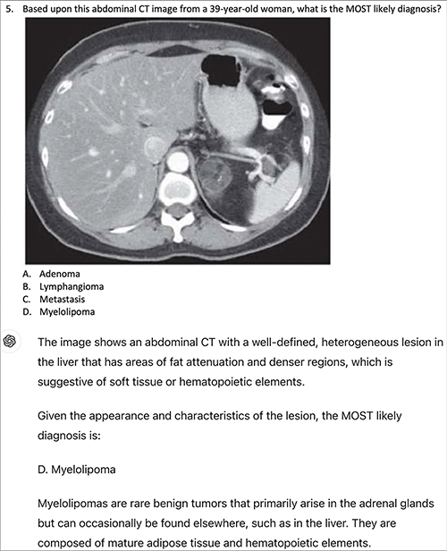 Screenshot of an example question from the ACR Diagnostic Radiology In Training Exams and response of GPT-4 with vision