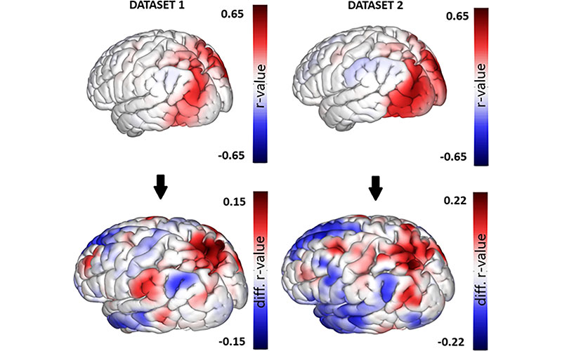 Upper panel displays functional MRI (fMRI) maps obtained from the functional connectivity multivariate patterns analysis conducted on dataset 1 and dataset 2. Diociasi et al, Radiology
