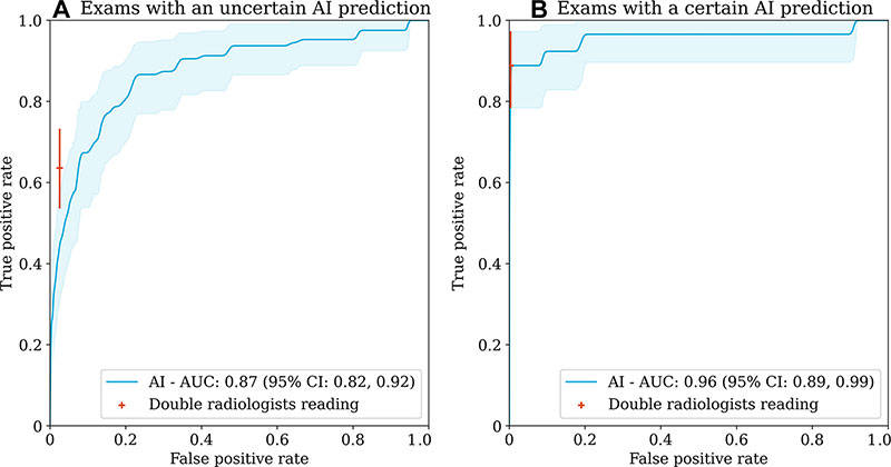 Receiver operating characteristic curves and their 95% CIs, as shown by the shaded area, for (A) the examinations where the AI model was uncertain and (B) the examinations where the AI model was certain.