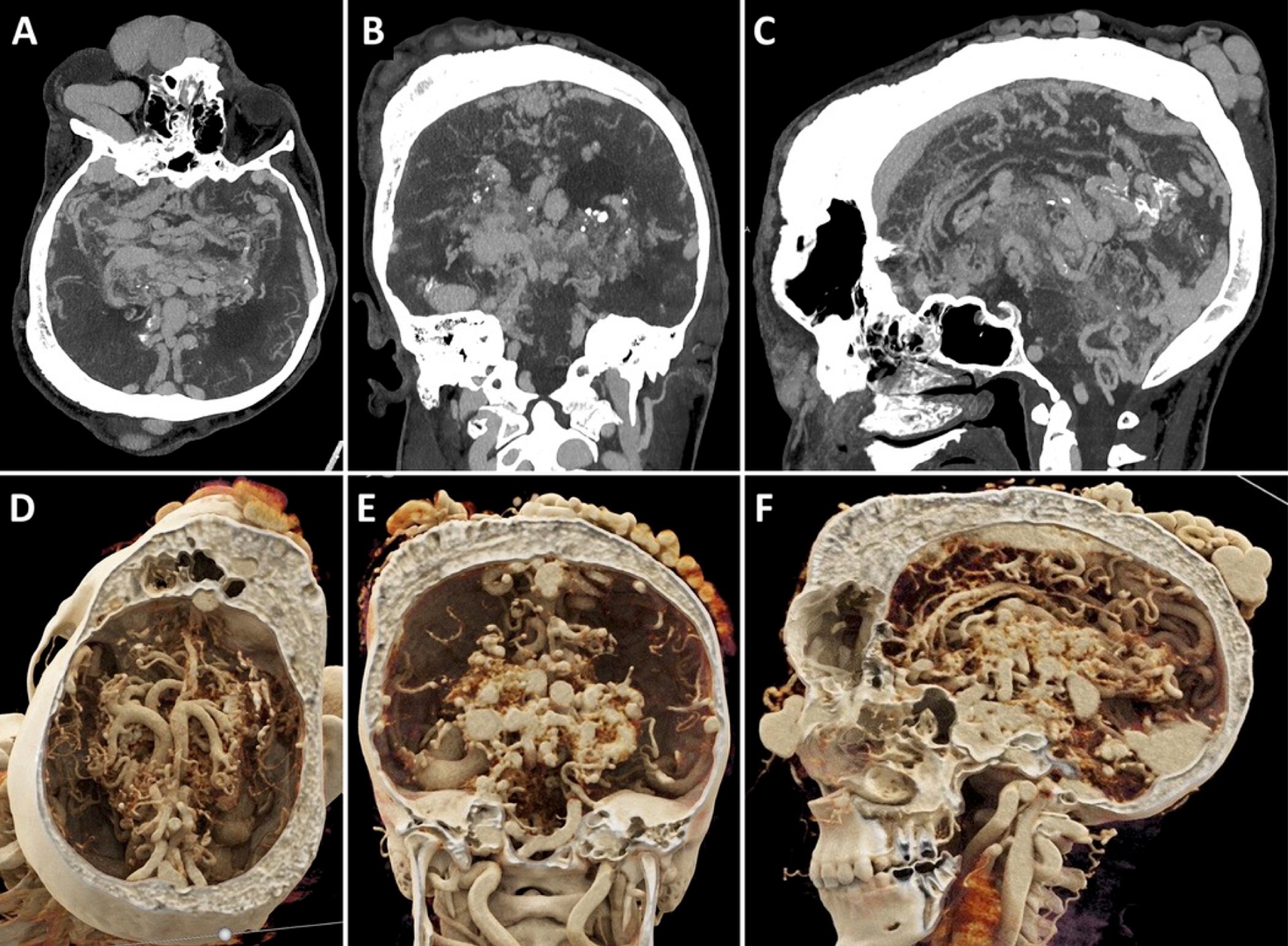 2025 Top Images in Radiology first place