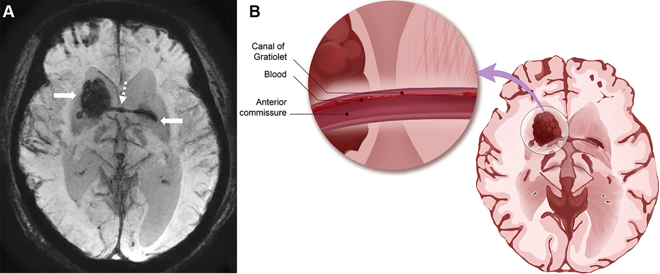 2025 Top Images in Radiology second place