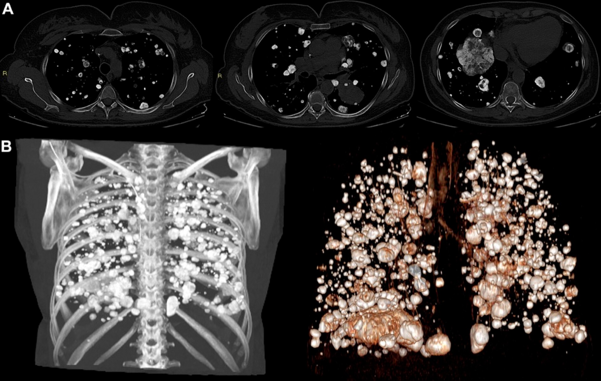 2025 Top Radiology Images third place