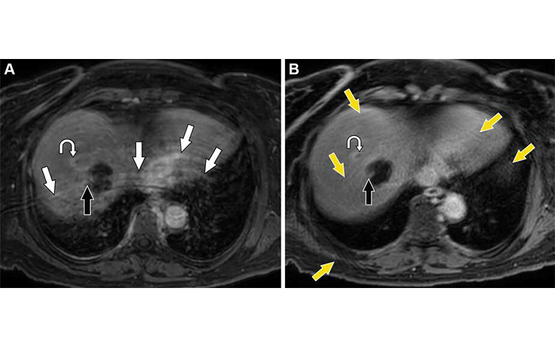 https://doi.org/10.1148/rg.230173 © RSNA 2024